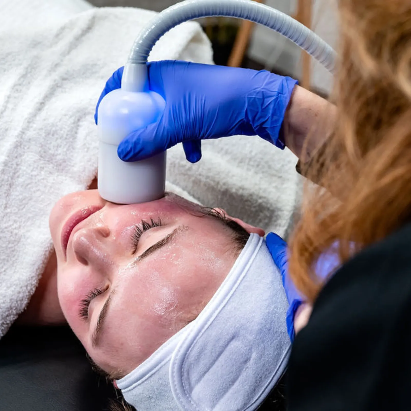 Neveskin Face & Neck treatment at iCRYO Okatie-Bluffton