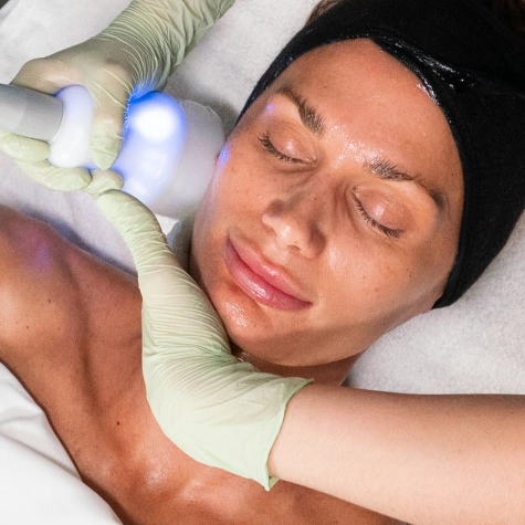 Neveskin Face & Neck facial at iCRYO Okatie-Bluffton